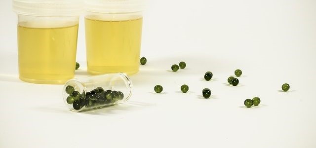 Synthetic Urine Upass Review Spring Estates Ridgefield WA